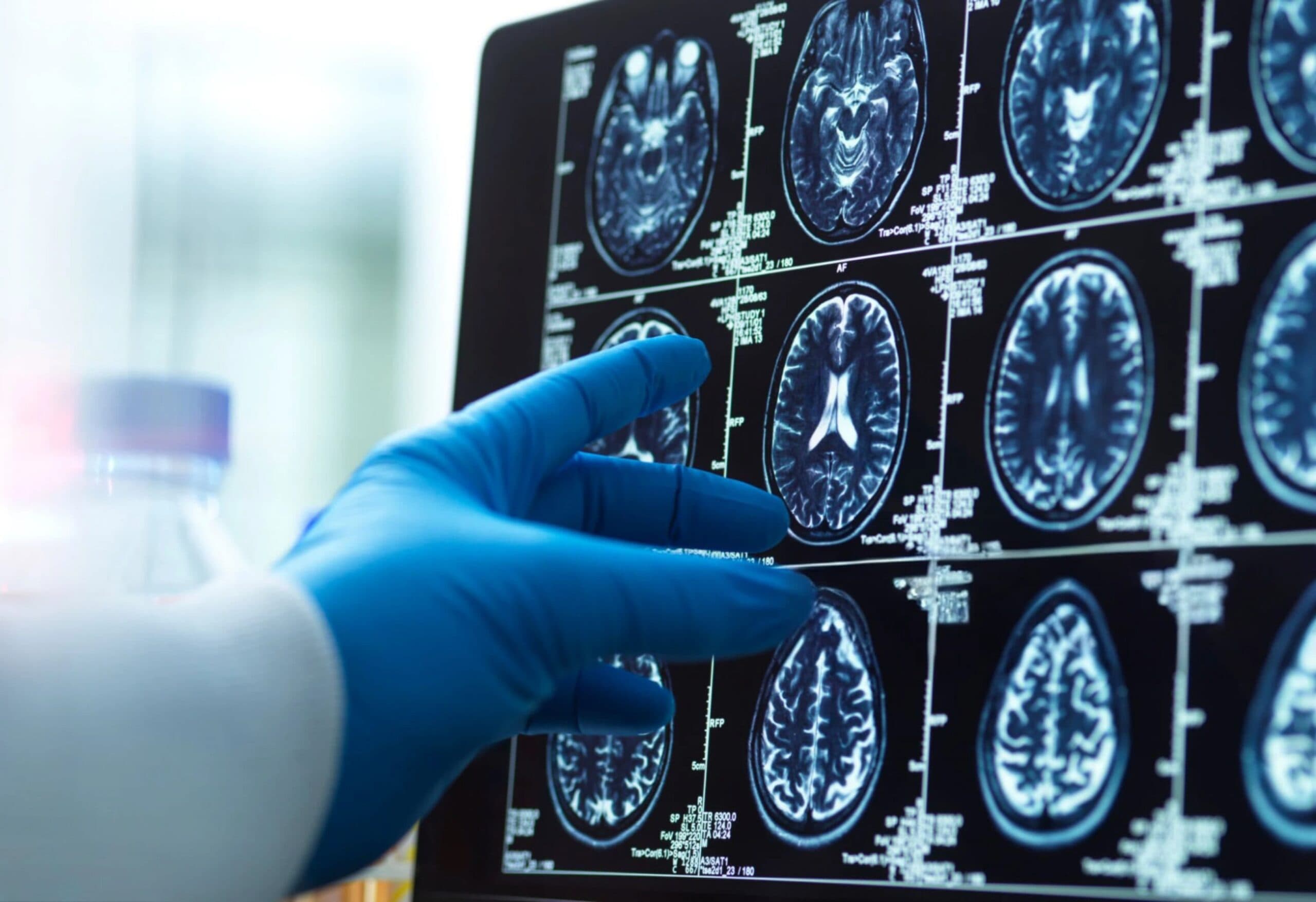 What We Learned: IWF and DAV’s Conversation on Military Brain Injury